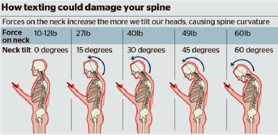 texting-damage-spine