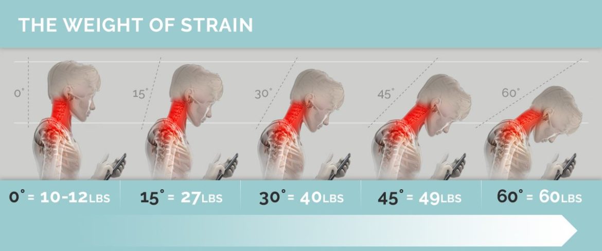 Tech Neck Weight Strain